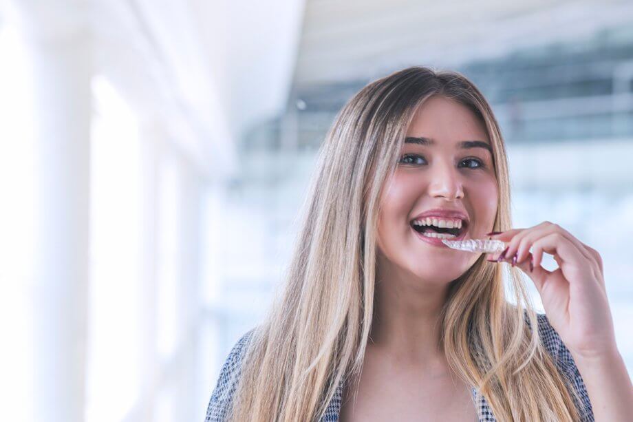 Benefits of Invisalign Over Traditional Braces