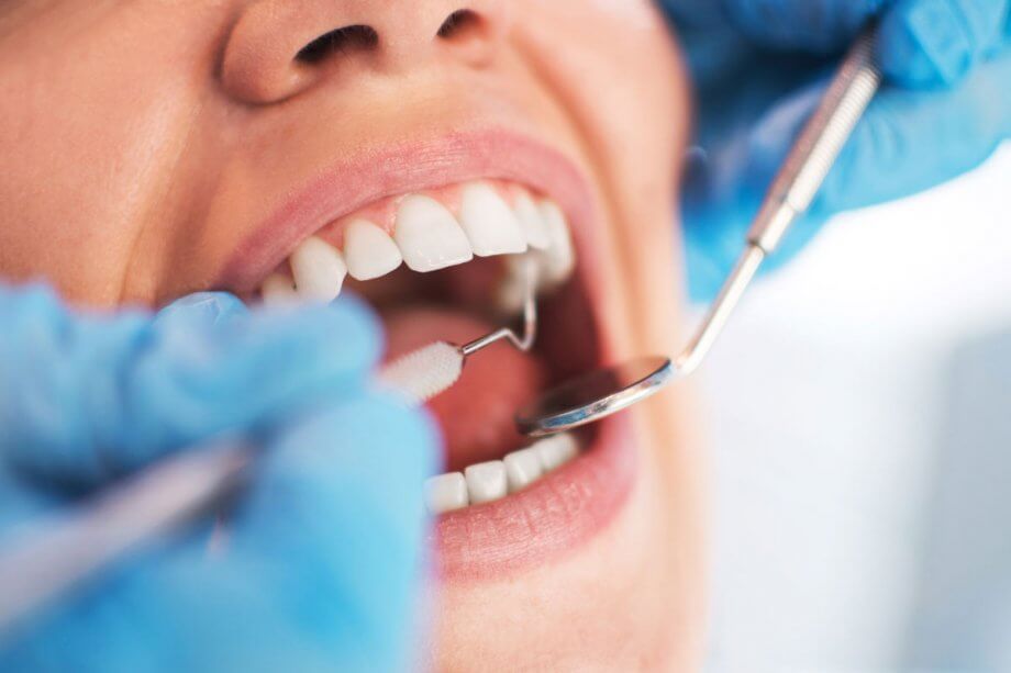close up of dentist checking teeth for cavities