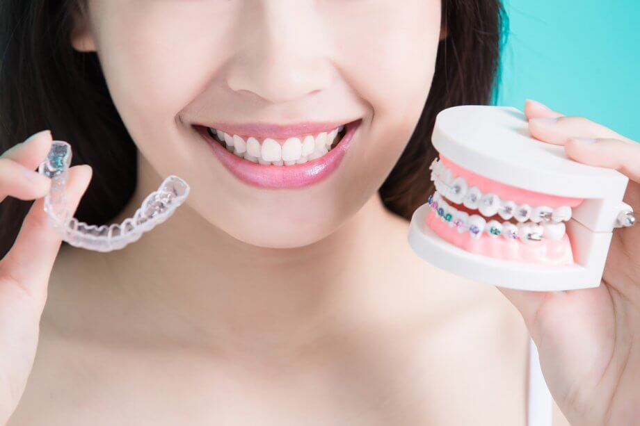 invisalign verses traditional braces